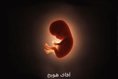 سزارین خطر مبتلا شدن به آلرژی غذایی را در نوزاد افزایش نمی دهد