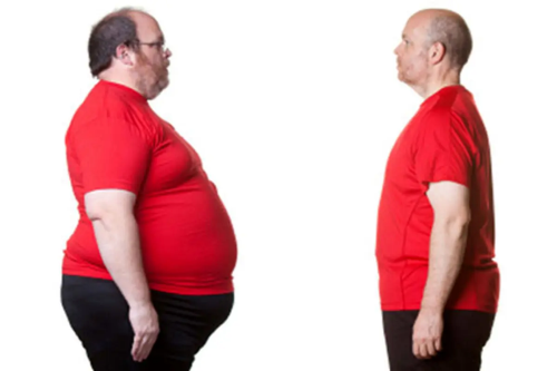 یک تکنیک نوآورانه برای کاهش وزن به روش غیرجراحی