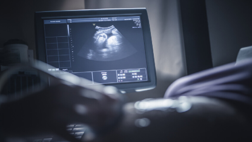 پیشگیری از سقط ۱۵۰۰۰ جنین با اجرای طرح نفس