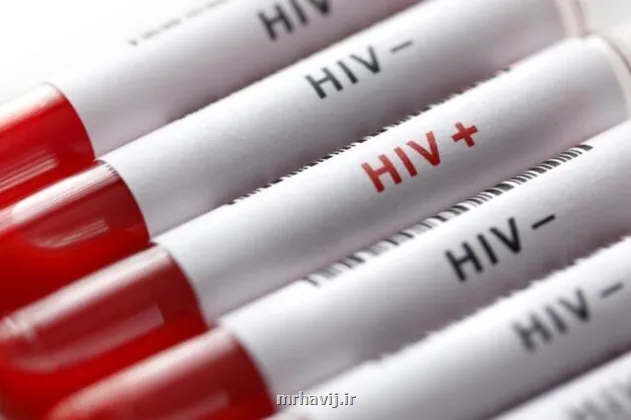 آغاز پویش من هم تست HIV می دهم از امروز تا 20 آذرماه