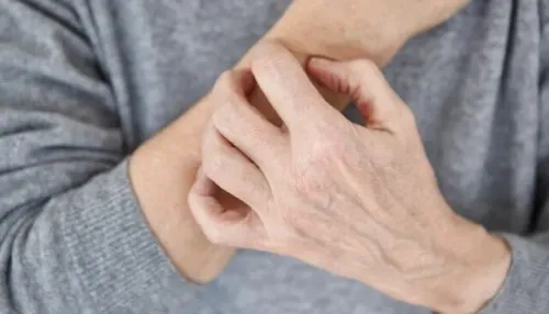 نشانه های پوستی که از بیماری خبر می دهند